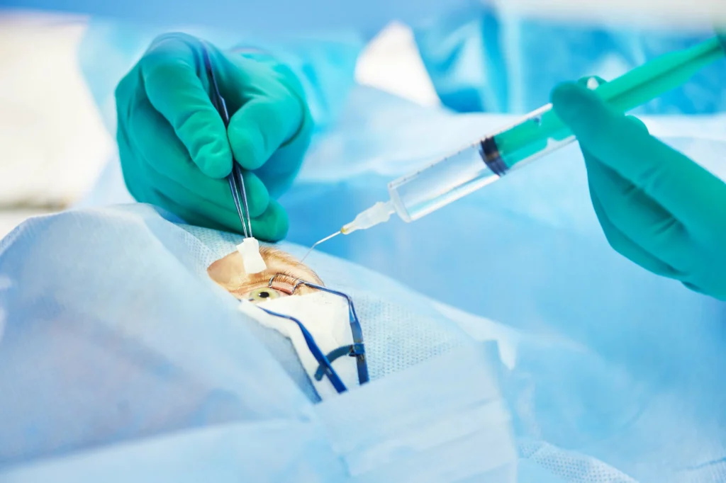 إجراء 400 عملية جراحة بقافلة صحية مجانية لإزالة المياه البيضاء بإقليم بولمان